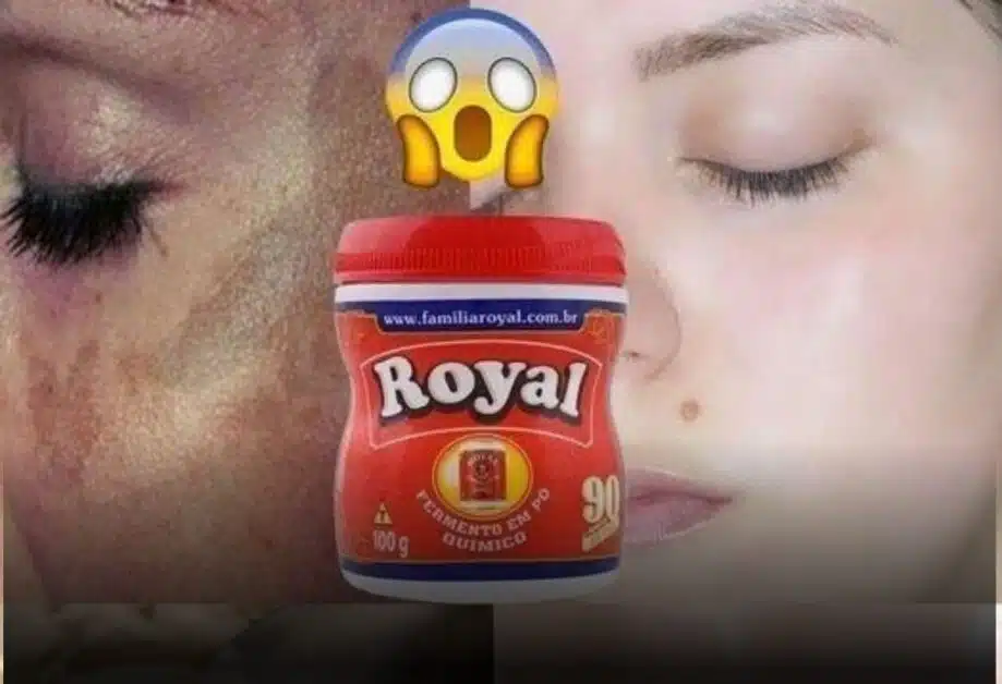 Como usar pó royal para remover manchas