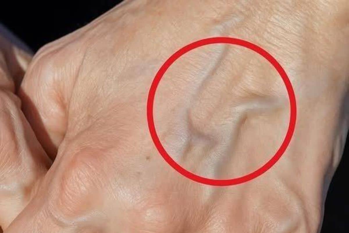 Preste atenção: isso é o que significa se você tem veias visíveis e saltadas