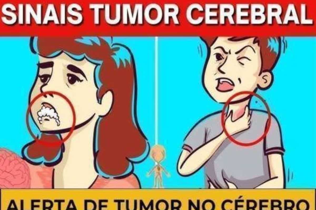 10 sinais de alerta de que você tem um possível tumor Cérebro