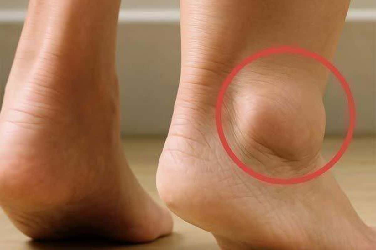 Pés inchados o que pode ser e o que fazer