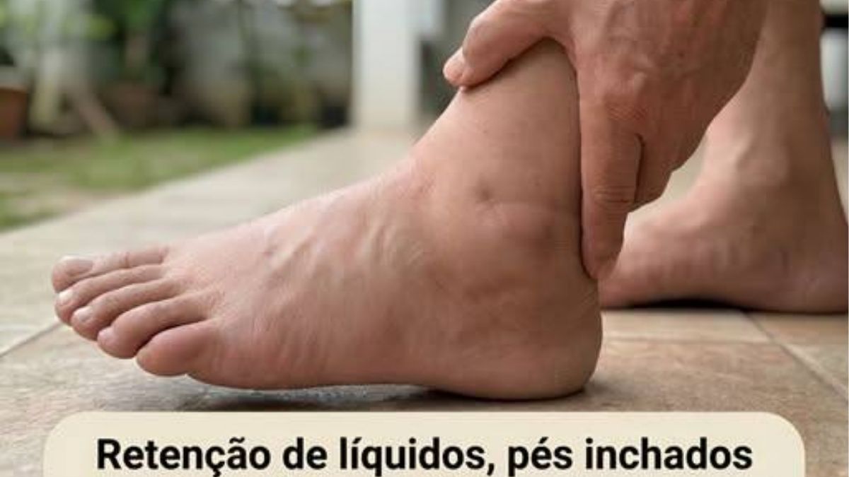 Folhas de Goiaba: Um Aliado Natural para o Bem-Estar Digestivo, Inchaço e Equilíbrio do Corpo